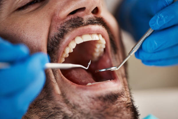 Best Weekend Emergency Dentist in New Middletown, OH