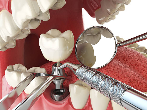 Best Emergency Cosmetic Dentistry in New Middletown, OH