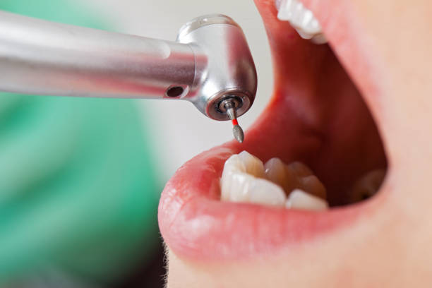 Best Emergency Dental Extractions in New Middletown, OH